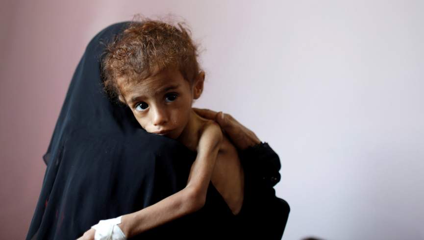 هر ۱۱ دقیقه یک طفل در یمن جان می‌دهد